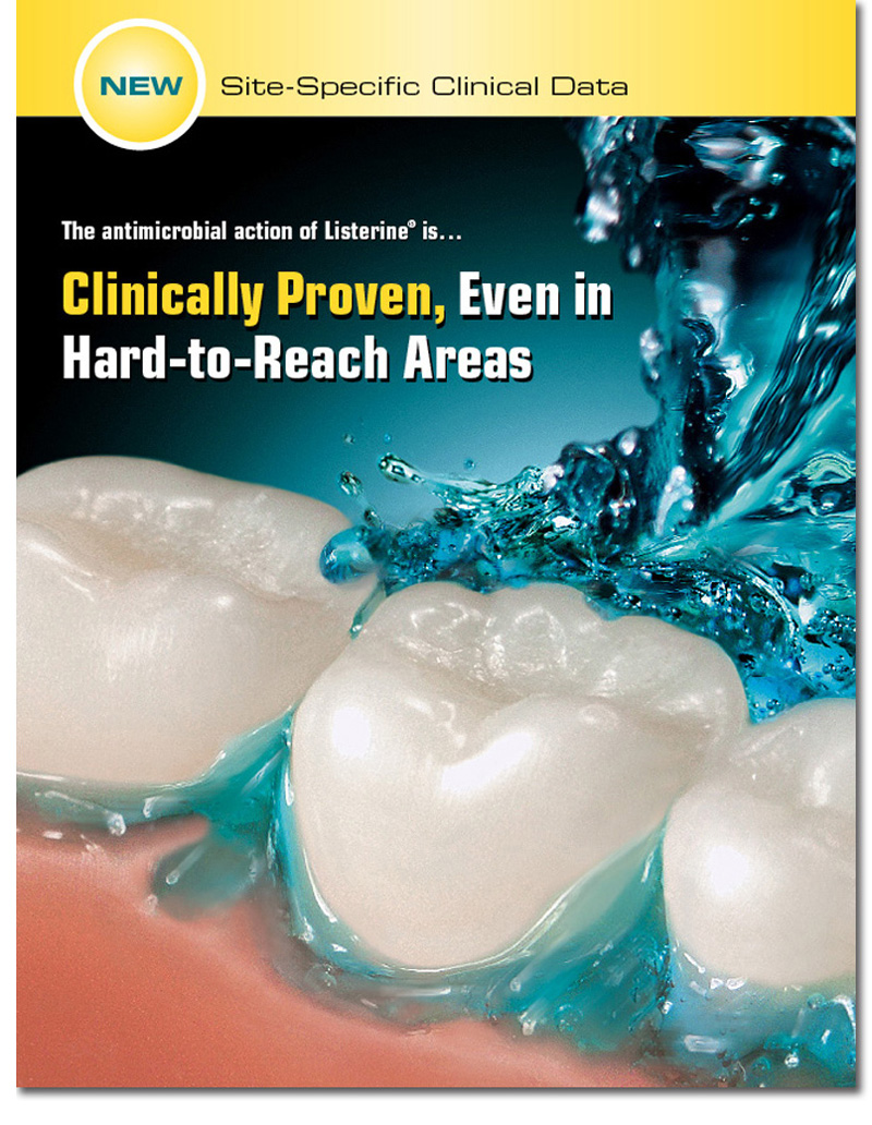 listerine